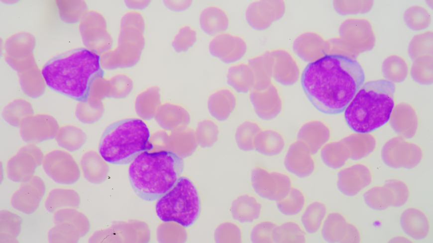 Halten av olika vita blodkroppar kan mätas i ett blodprov för att se om en inflammatorisk process pågår eller om immunförsvaret är nedsatt. Foto: Shutterstock